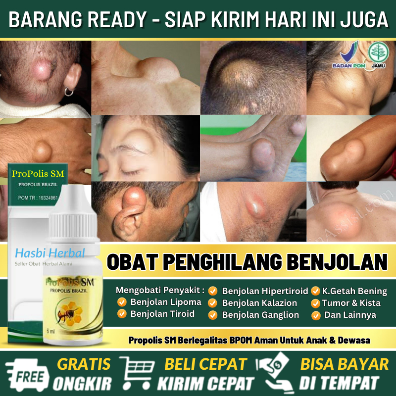 Pengobatan Herbal Penyakit Benjolan Pada Anak & Dewasa, Obat Melenyapkan Benjolan Abnormal di Tubuh,