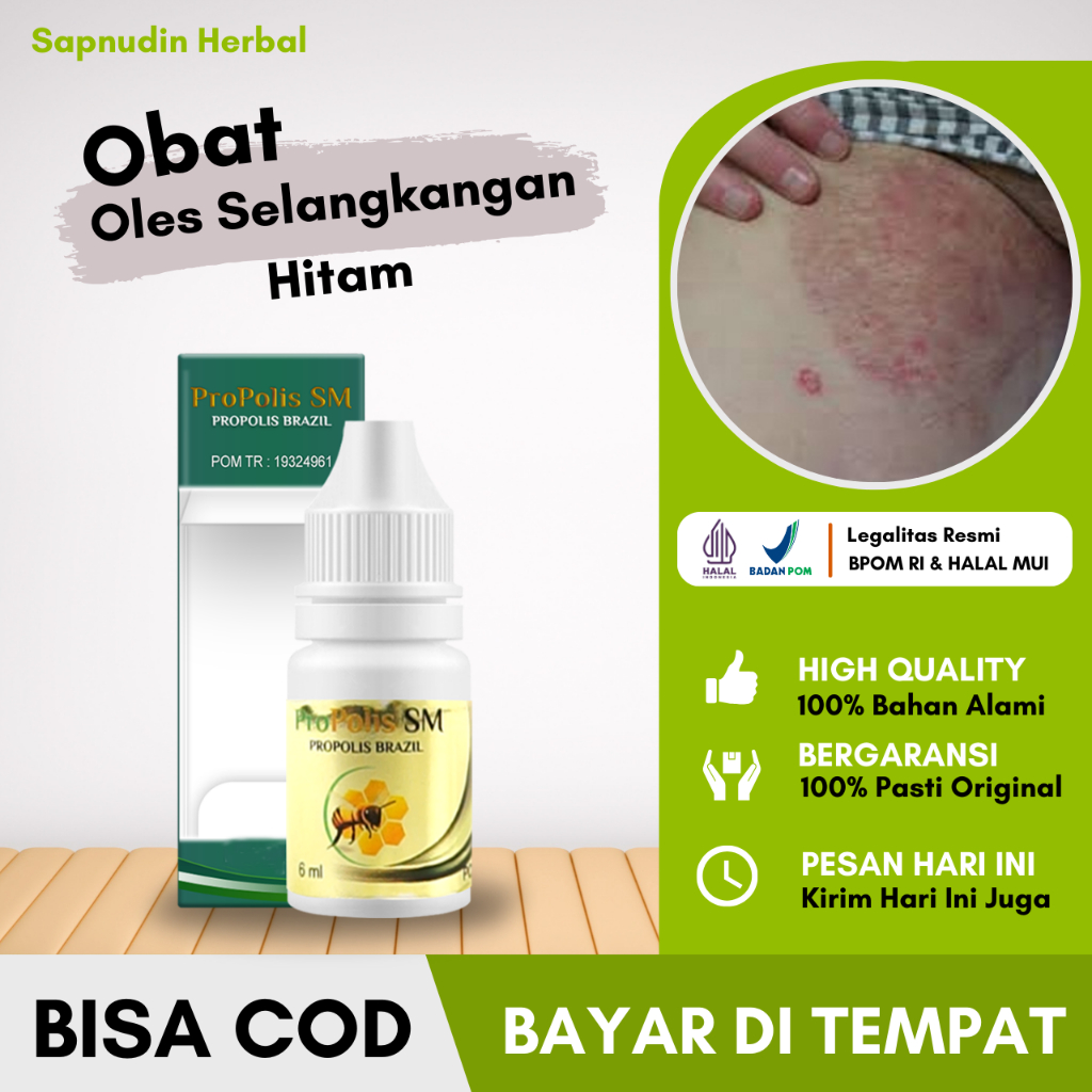 Obat Oles Selangkangan Hitam, Penghilang Hitam Di Selangkangam, Penghilang Gatal Di Selangkangan, Ja