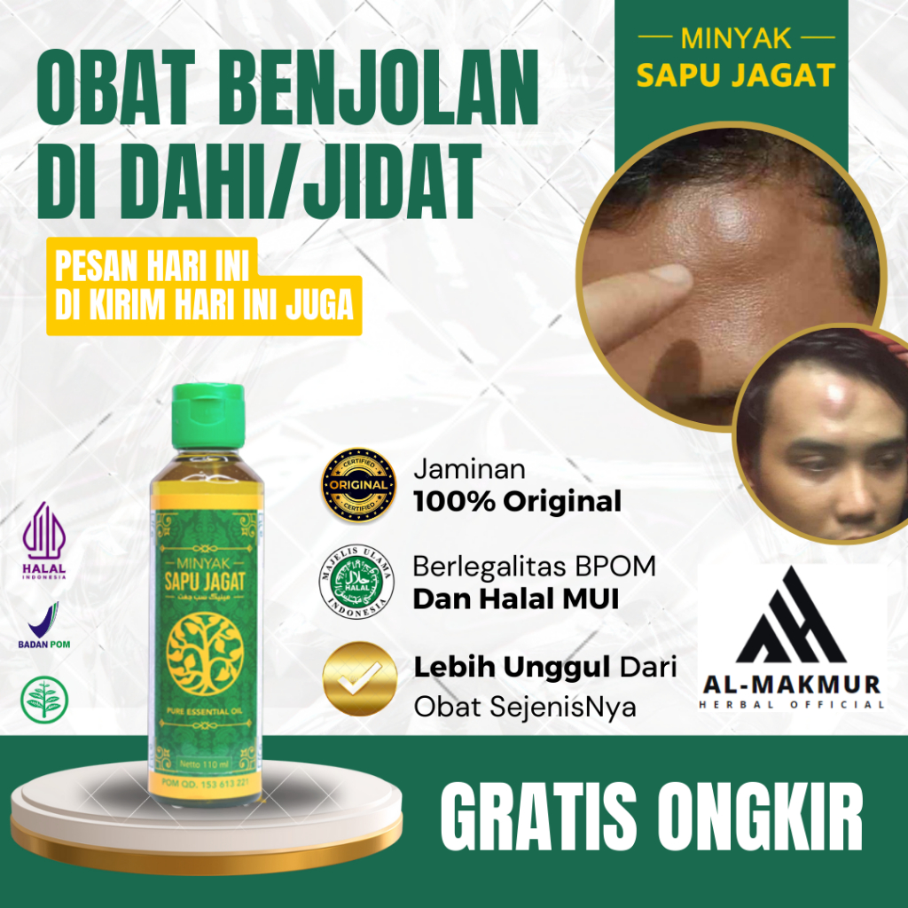 Obat Benjolan Di Dahi, Obat Benjolan Di Kepala, Obat Benjolan Di Jidat, Obat Oles Pengecil Benjolan 