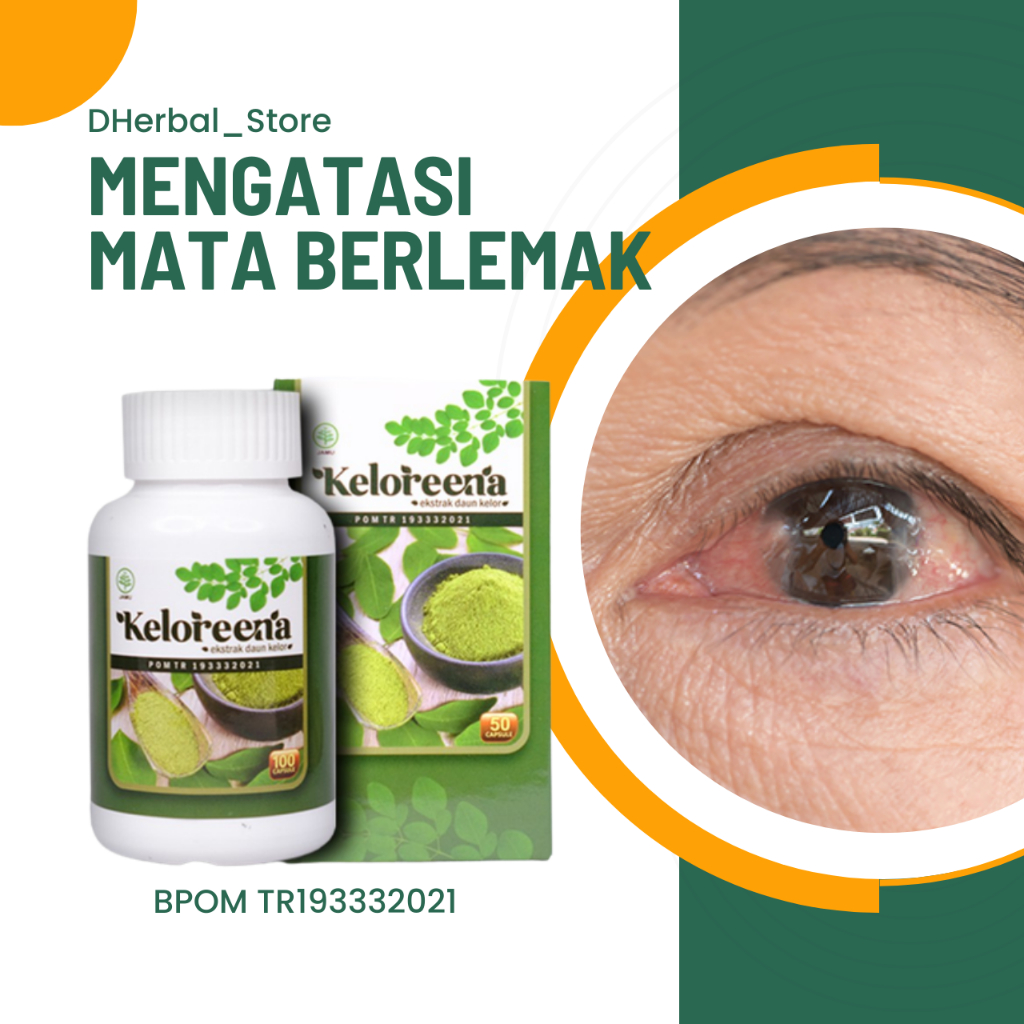 Keloreena, Obat Mata Berlemak, Obat Mata Pterygium, Obat Penghilang Lemak Mata, Obat Lemak di Selapu
