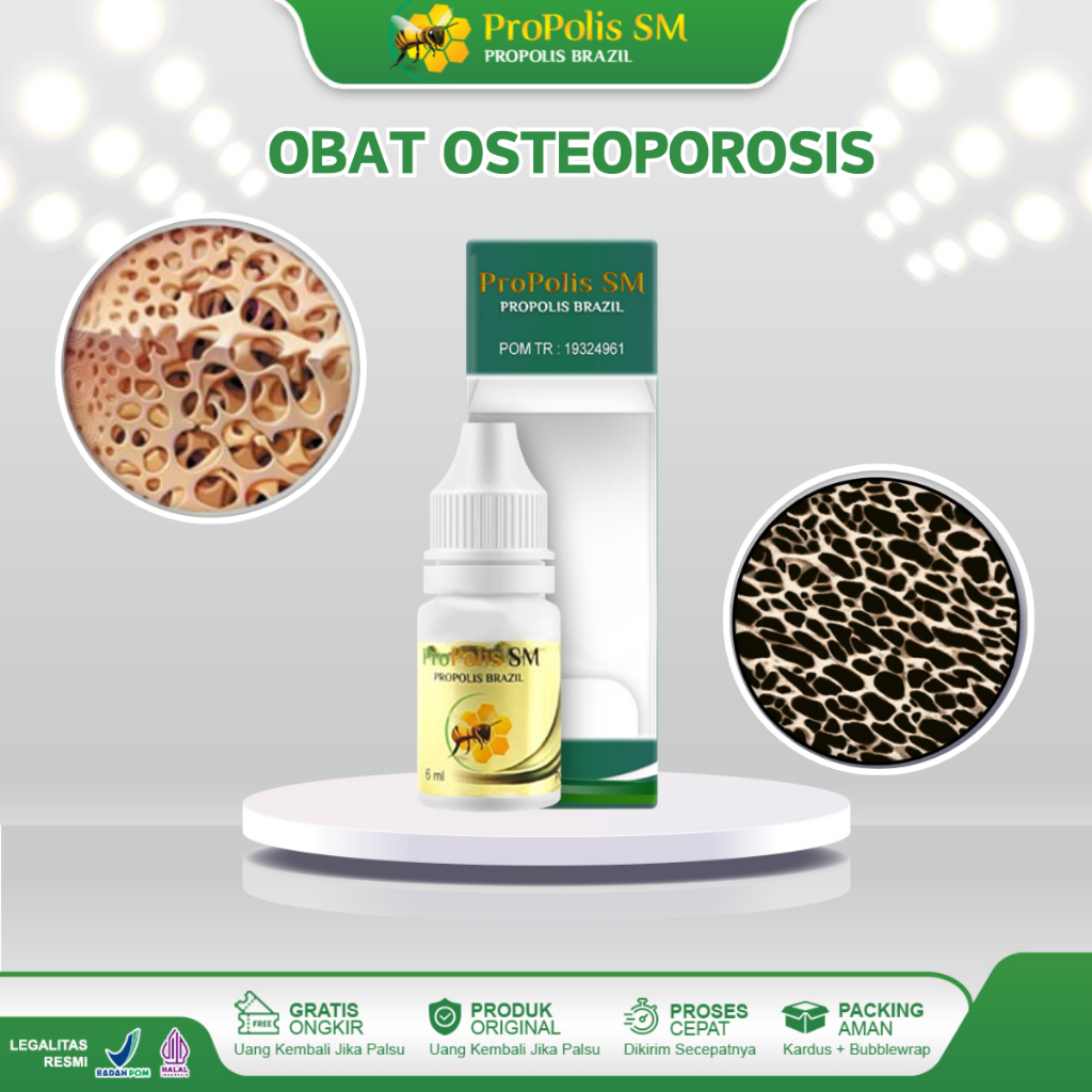 Obat  Osteoporosis, Pengapuran Tulang dan Sendi Tulang Pinggang Pengapuran Tulang Belakang Pengapura