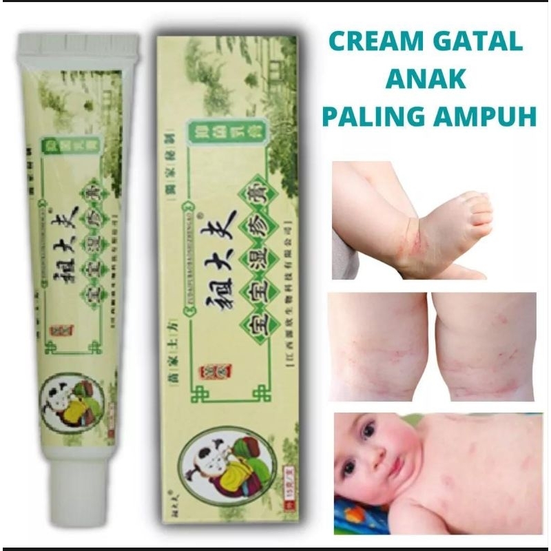 salep cream gatal cina untuk anak