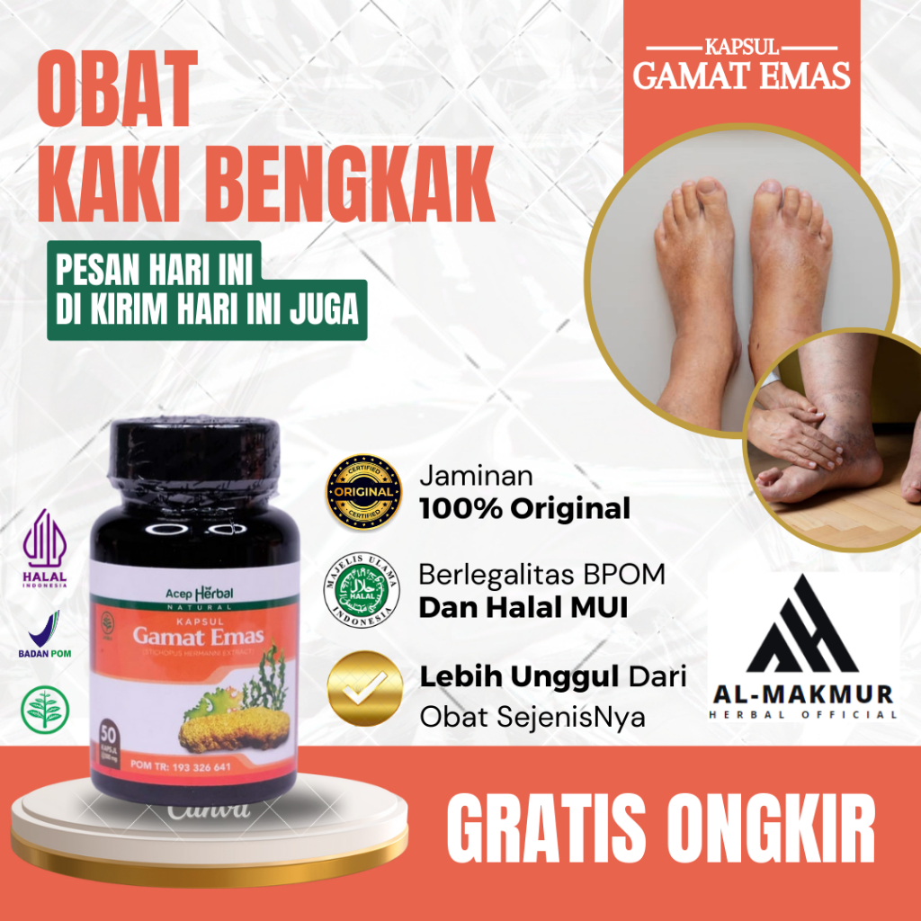 Obat kaki Bengkak Dan Nyeri, Obat Kaki Bengkak Asam Urat, Obat Bengkak Ibu Hamil, Obat Kaki Terkilir
