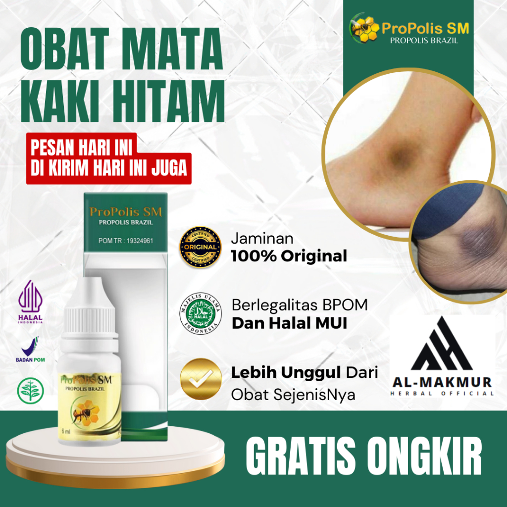 Obat Mata Kaki Hitam, Obat Penghilang Mata Kaki Hitam, Obat Pembersih Daki Di Mata Kaki, Obat Pemuti