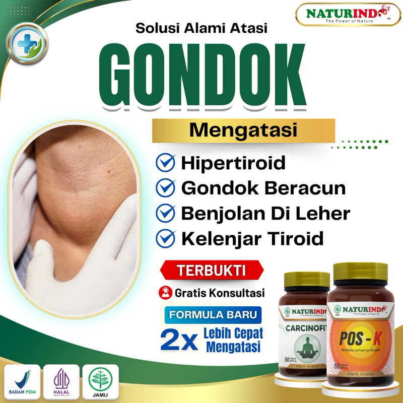 Obat Gondok Benjolan Di Leher Ampuh Tiroid Hipertiroid Gondok Beracun