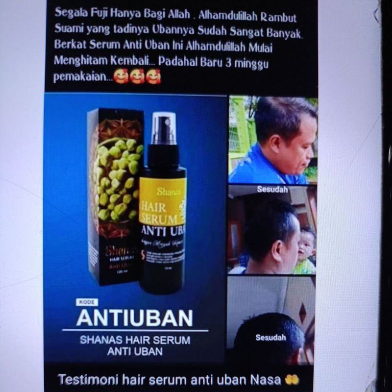 hair serum anti uban
