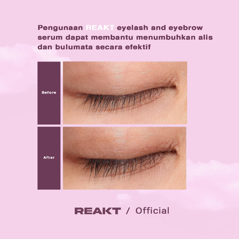 REAKT Minoxidil 2% Premium Serum Penumbuh Bulu Mata dan Alis / Eyelash and Eyebrow Serum Terbaik