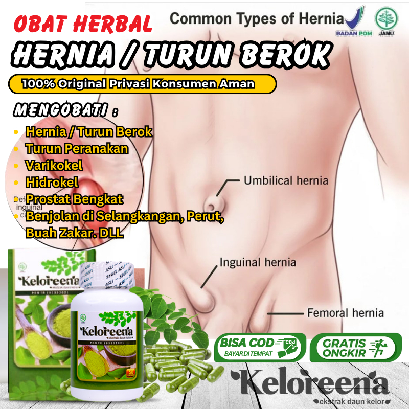 Obat Benjolan di Selangkangan Akibat Hernia 100% Herbal, Penyembuhan Hernia Pria, Pembengkakan Testi