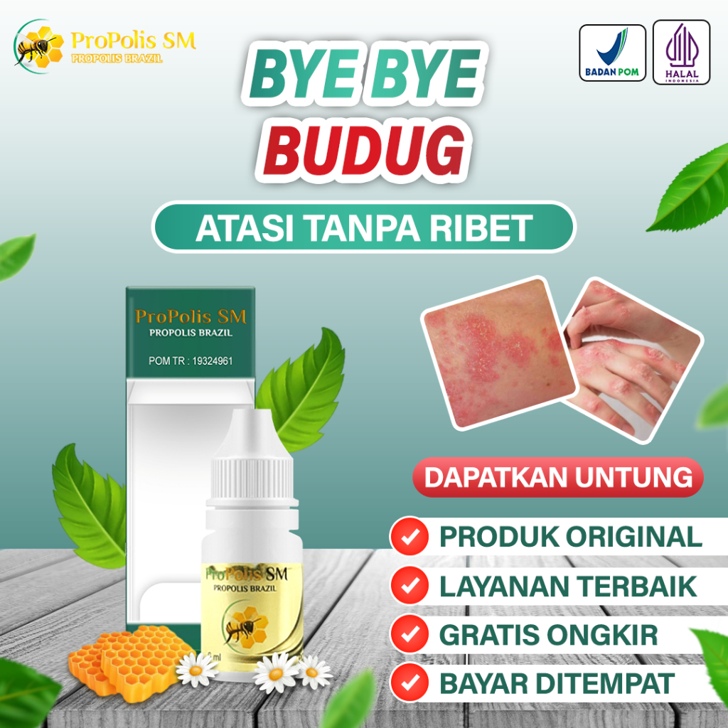 Obat Budug Di Kaki Tangan Badan, Penghilang Bekas Budug Kaki Korengan Obat Kudis, Gatal Gatal, Kulit