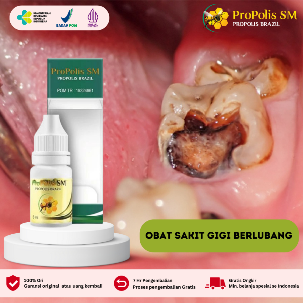 Obat Sakit Gigi Berlubang, Obat Gigi Keropos Berlubang, Obat Gusi Bengkak Ngilu Sakit Goyang dan Nyu