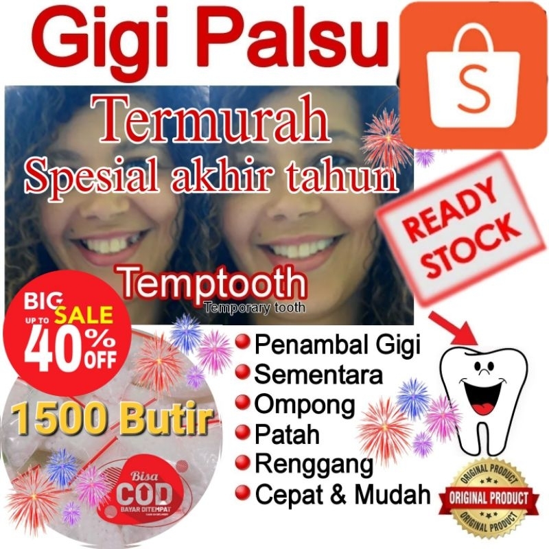 Temptooth ori isi 1.500 Butir  / tambal gigi / gigi ompong / gigi kelinci / gigi rusak / gigi patah
