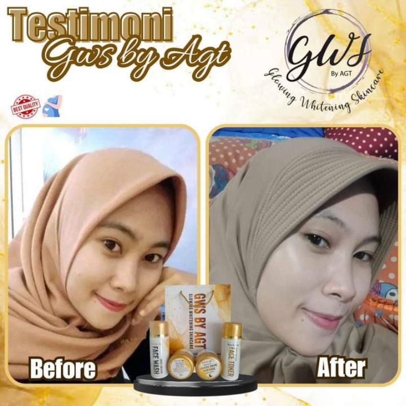 GWS BY AGT