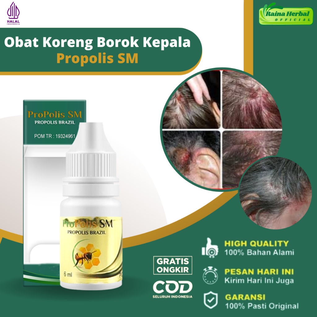 Obat Koreng Di Kepala Borok Bernanah Kulit Kepala Psoriasis Kulit Kepala Bersisik Berkerak Kering Ob