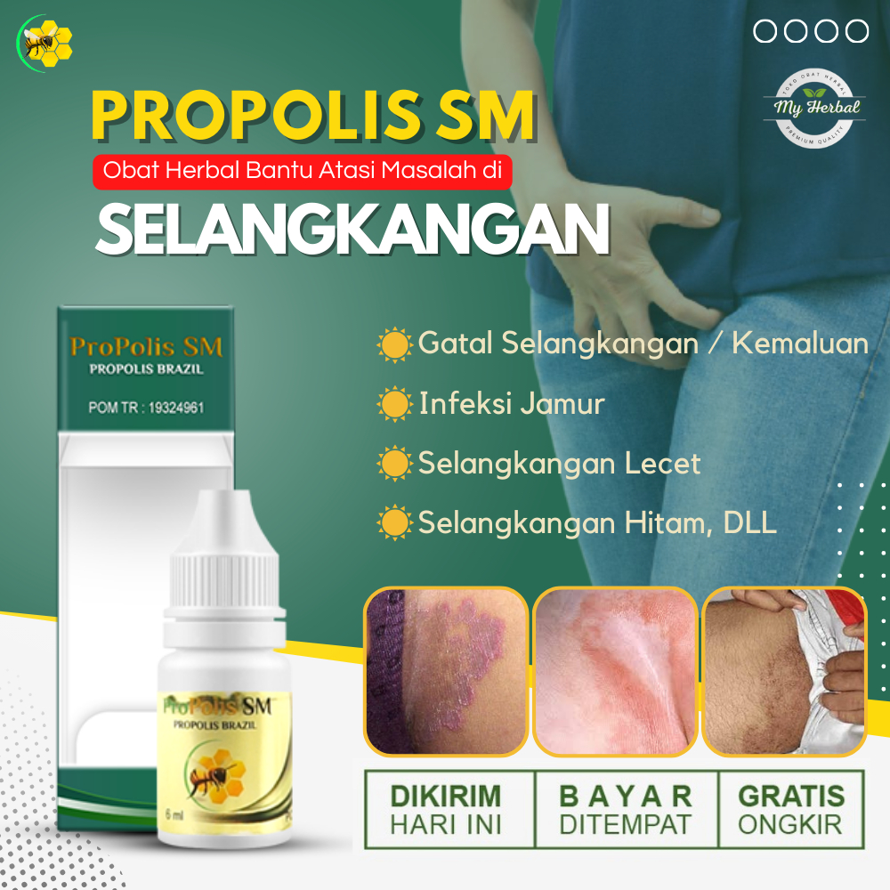Obat Selangkangan Gatal, Selangkangan Lecet / Babak, Obat Oles Penghilang Gatal Selangkangan, Selang