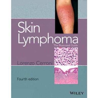 Skin Lymphoma: The Illustrated Guide