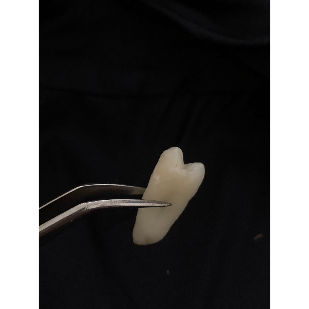 GIGI ASLI PREMOLAR PRAKTIKUM