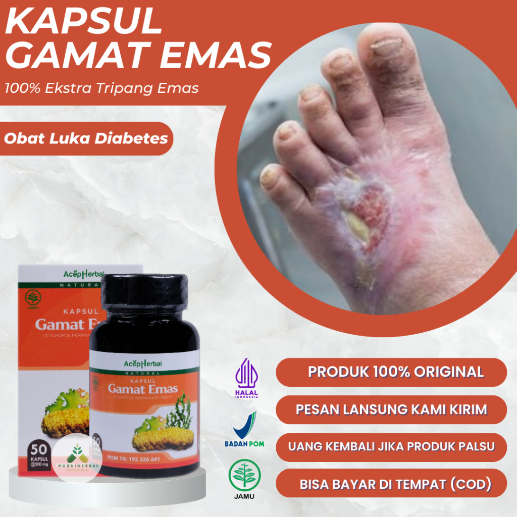 Gamat Emas Kapsul - Obat Luka Diabetes, Diabetes Basah / Kering, Diabetes Bernanah, Diabetes Melitus