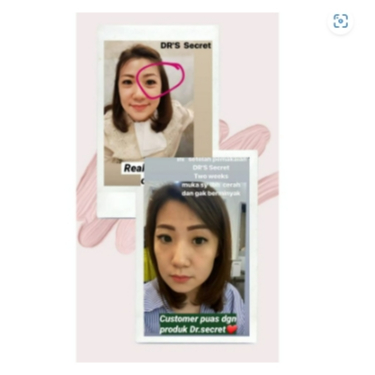 SKIN CARE DR'S SECRET AESTIER EYE CREAM