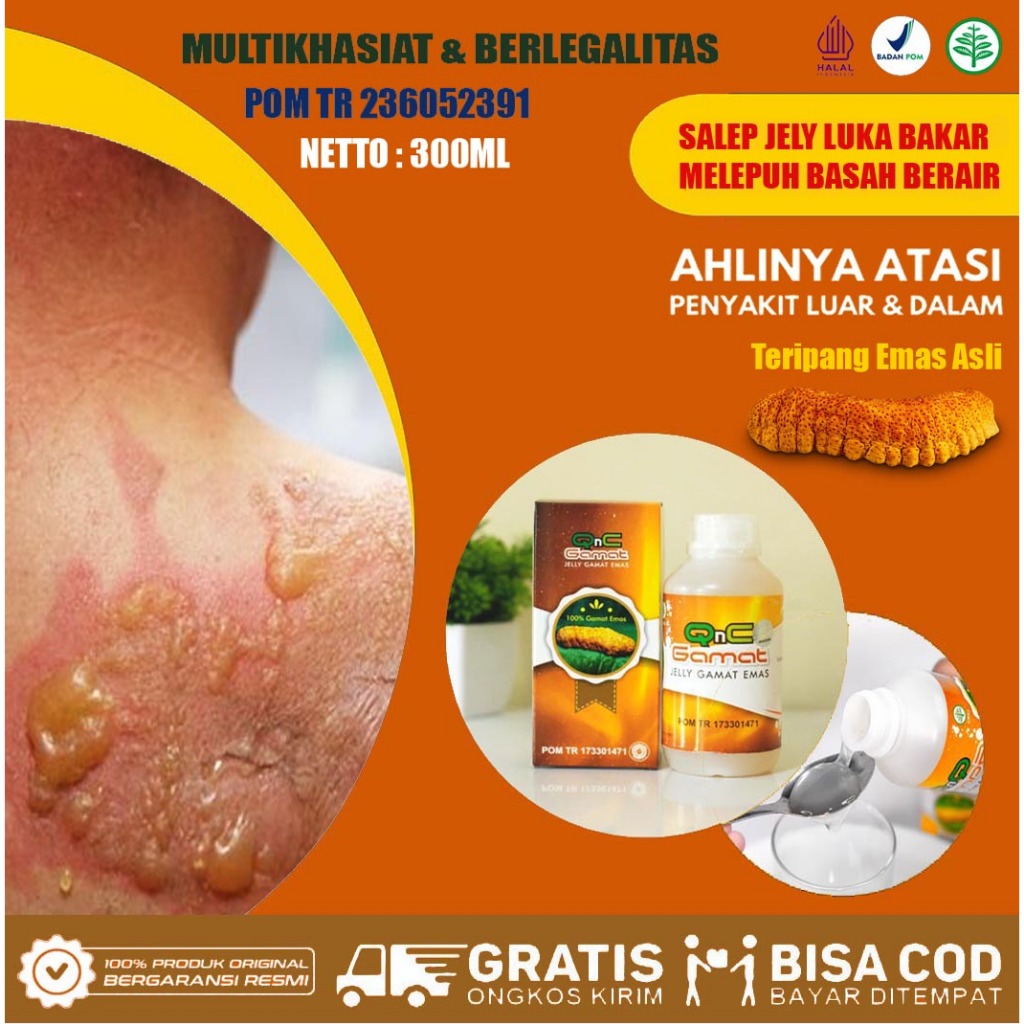 Obat Penghilang Bekas Luka Salep Penghilang Bekas Luka - Obat Herbal Pengering Luka Diabetes, Luka J