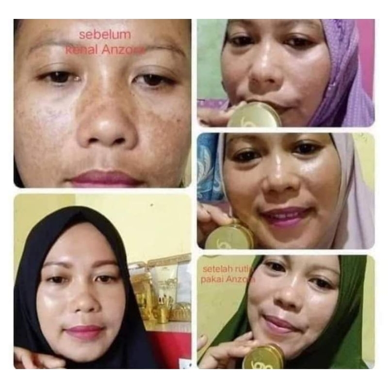 anzora series renewal