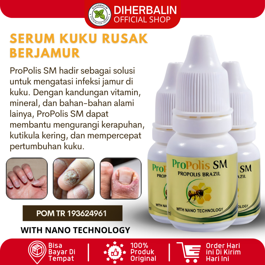 Obat Jamur Kuku Rusak Vitamin Kuku Rusak BerJamur Serum Kuku Jamur dan Rusak Halal ProPolis SM 6ml H