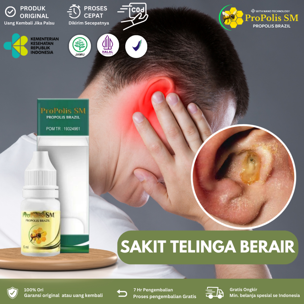 Obat Telinga Congek dan Bernanah, Obat Sakit Telinga Congek, Berair Dan Bau, Berdenging, Bernanah, P