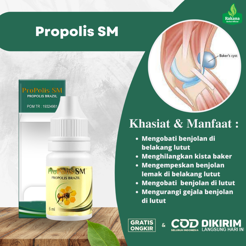 Obat Benjolan Di Belakang Lutut, Obat Kista Baker, Obat Benjolan Di Lutut Sebelah Kiri Kanan, Obat P