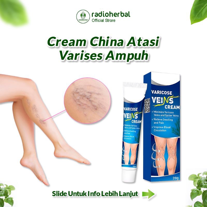 Cream herbal china varises kaki ampuh