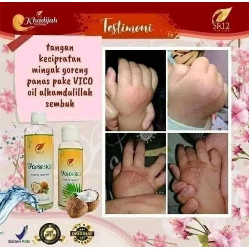 

HG Vco Virgin Coconut Oil/Minyak Kelapa Murni/Vico Oil SR12