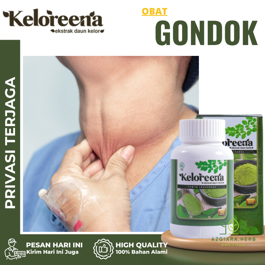Obat Gondok, Obat Benjolan Di Leher,  Obat Gondok Beracun, Obat Kelenjar Getah Bening, Obat Lipoma, 