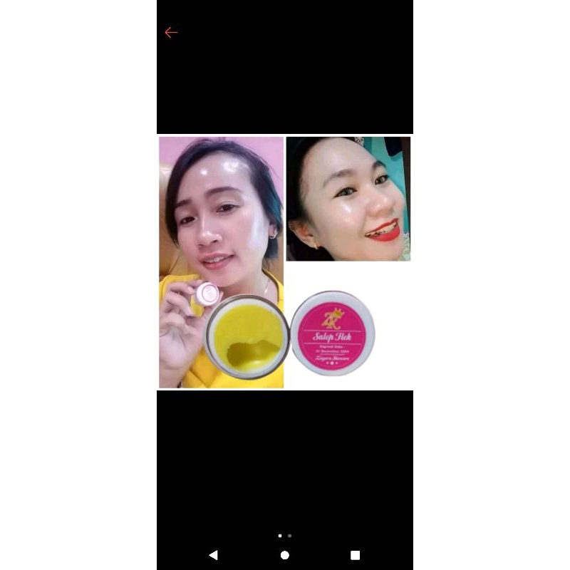 SALEP FLEK GLOW ZAYORA ORI 100% AMPUH MENGATASI FLEK WAJAH UK 5gr