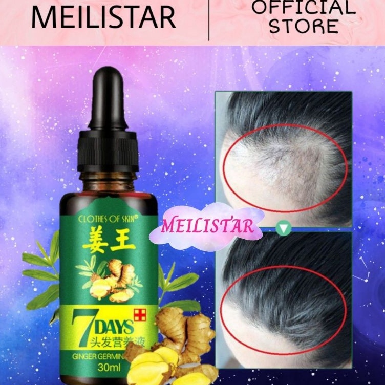 ORIGINAL Cairan Essence Obat Penumbuh Rambut King of Ginger Germinal Clothes of Skin 7 Days Serum Rambut Botak 3ml