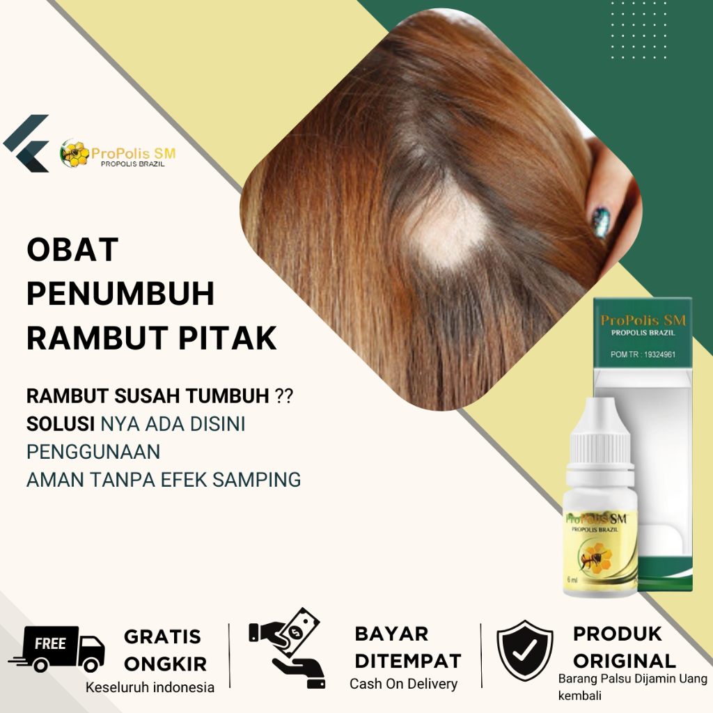 Obat Alopecia Areata Jamur Kulit Kepala, Obat Penumbuh Rambut, Obat Penumbuh Rambut Cepat, Serum Pen