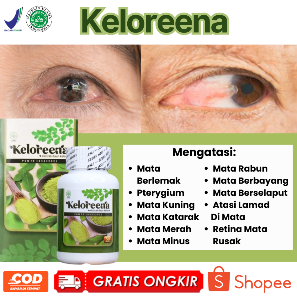 Obat Mata Pterygium Penghilang Pterygium Pembersih Pterygium Mata Berlemak Mata Katarak Mata Kuning 