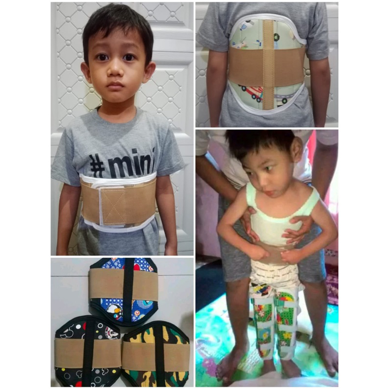 Korset anak karakter (korset tulang belakang)