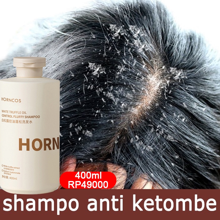 Shampoo anti ketombe Truffle putih Obat ketombe sampo penghilang ketombe 400ML Kontrol oil& anti gat