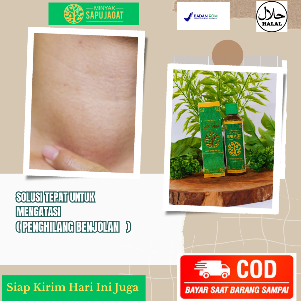 Minyak Oles Penghancur Benjolan, Obat Penghilang Benjolan, Obat Benjolan di Ketiak, Obat Benjolan di