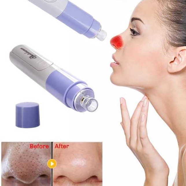 DIJAMIN ORI Alat Pembersih KomedoAlat Pembersih Komedo