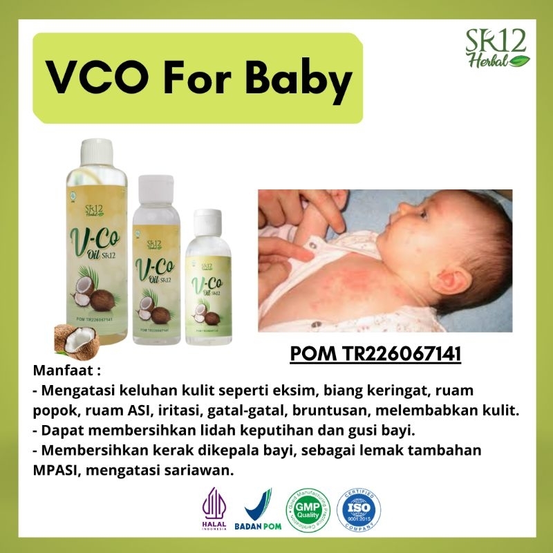 VCO SR12 Untuk Ruam Popok / VCO Untuk Bayi / Minyak Bayi / Biang Keringat / Minyak Kelapa Untuk Bayi