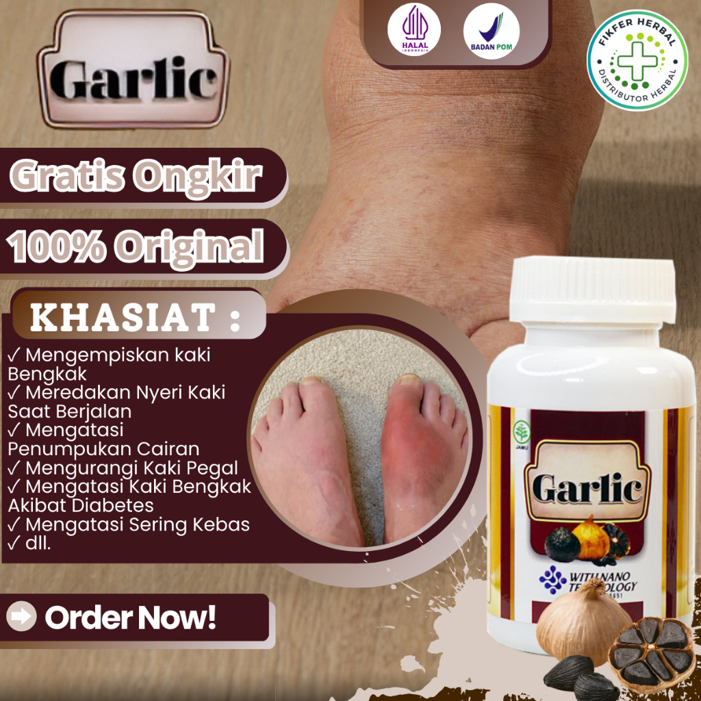 Obat Kaki Bengkak, Obat Nyeri Kaki Akibat Bengkak, Obat Sakit Kaki Saat Berjalan, Obat Kaki Bengkak 