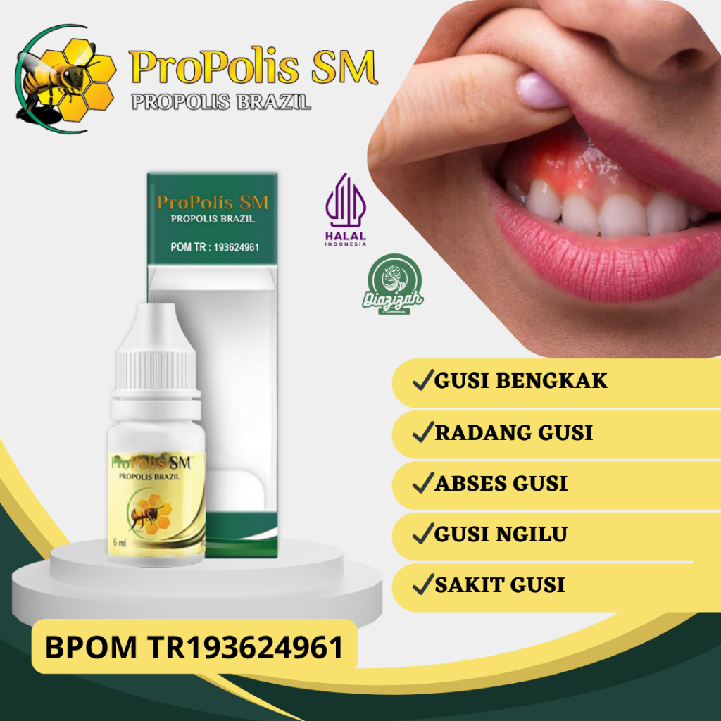 Obat Gusi Bengkak, Obat Gusi Ngilu, Obat Radang Gusi, Obat Abses Gusi, Obat Sakit Gusi, Obat Bengkak