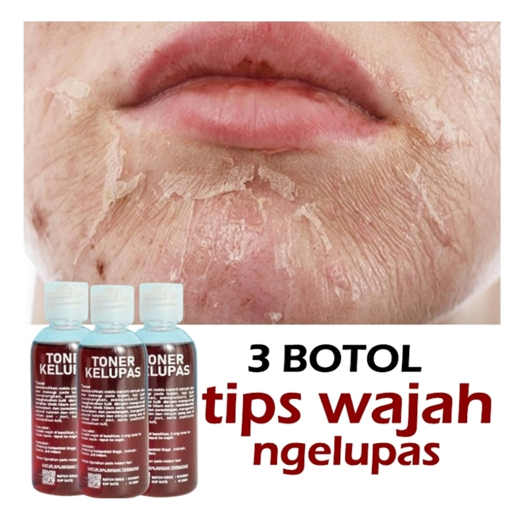 3 BOTOL TONER KELUPAS WAJAH COD TONER KELUPAS || TONER WAJAH PENGELUPASAN