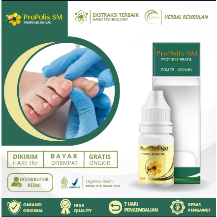 Obat Jamur Kuku, Obat Kuku Berjamur, Obat Kuku Rusak Berjamur, Obat Kuku Cantengan, Obat Kuku Rusak,