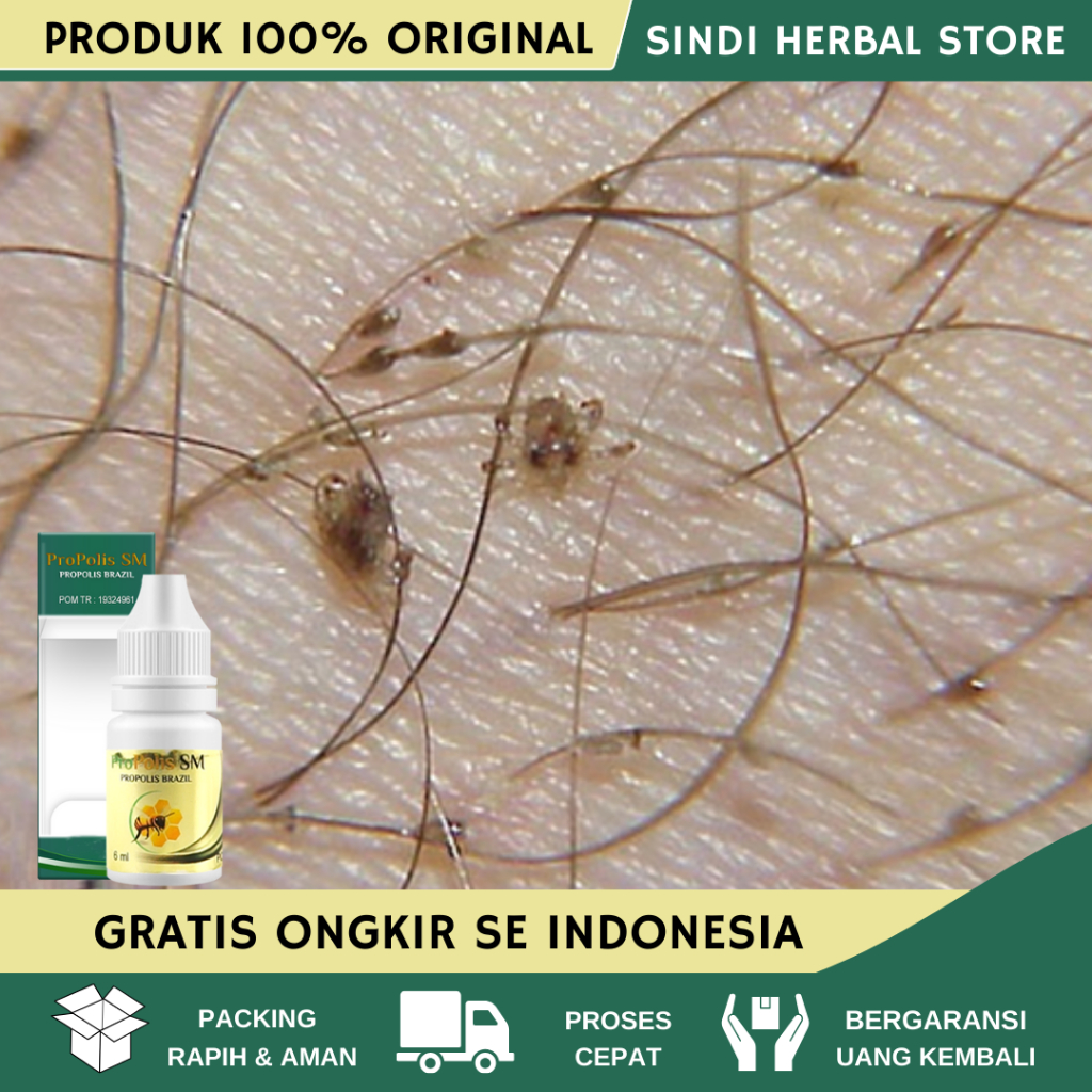 Obat Kutu Kemaluan Pria, Obat Kutu Kemaluan Wanita, Obat Penghilang Kutu Kemaluan, Obat Herbal Kutu 