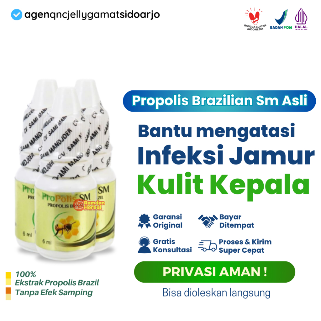 Obat Infeksi Jamur Kulit Kepala-Kulit Kepala Gatal Hebat-Borok-Tinea Capitis-Propolis SM Sudah BPOM