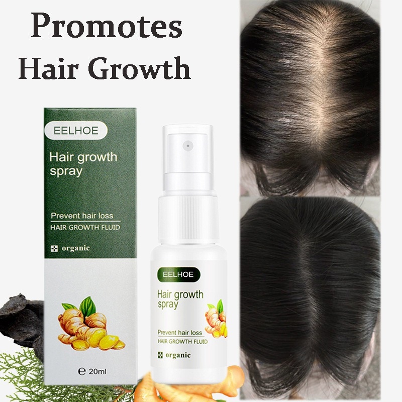 Obat penumbuh rambut botak depan pria wanita Eelhoe hair growth spray