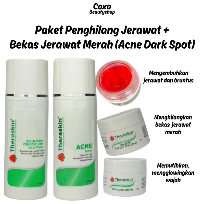 paket penghilang jerawat plus bekas jerawat merah hitam
