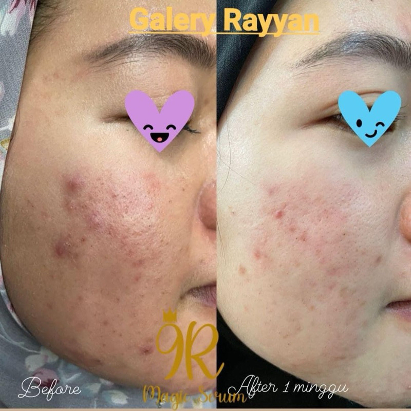 PAKET SKINCARE 9R