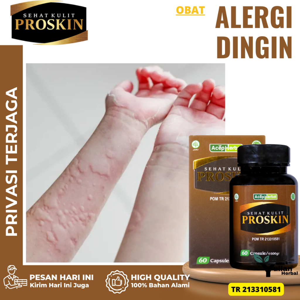 Obat Alergi Dingin, Obat Alergi Makanan, Obat Biduran, Obat Kaligata Untuk Anak Dan Dewasa,  Obat Be