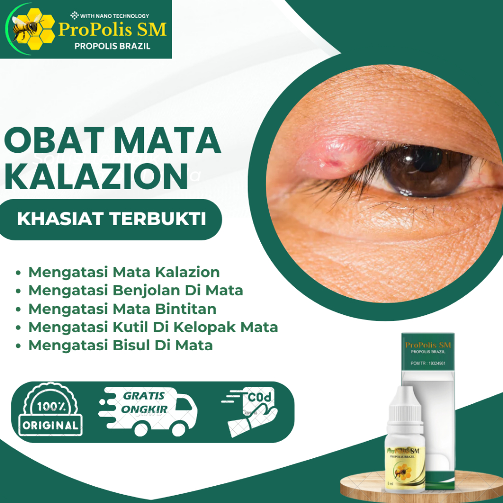 Obat Mata Kalazion Penghilang Benjolan Di Kelopak Mata Benjolan Di Kantung Mata Bintitan Bengkak Kut